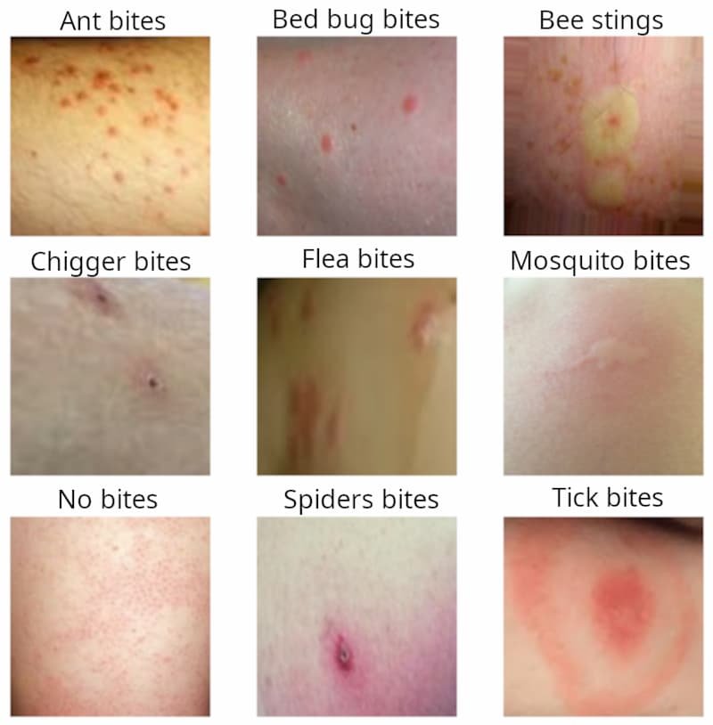 Differences Between Bites